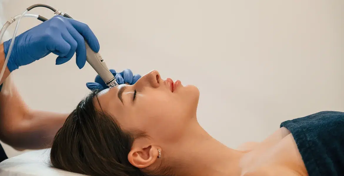 Unlocking Radiant Skin with Microneedling - The Pearl Med Spa
